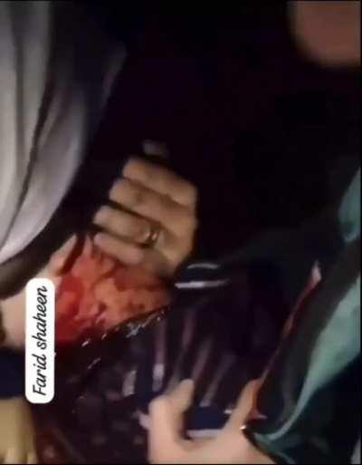 [Graphic] Palestinian boy takes his last breath after being wounded by IOF bomb.