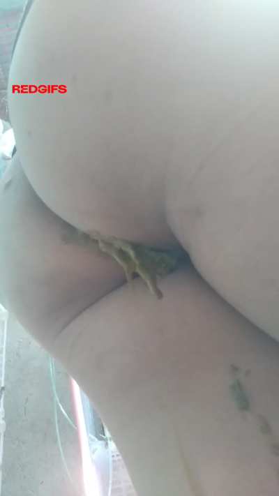 My ass is leaking. What will you do about it? [F]