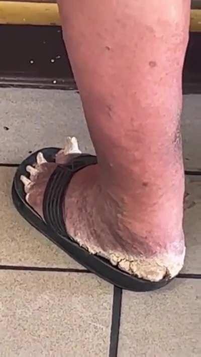 Leaving a trail of foot crumbs so he don't get lost