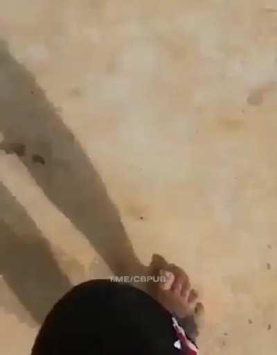 Gun play results in painful times