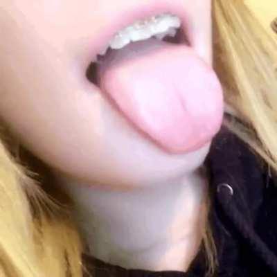 Only a little more karma until I can post slideshows of all my braces triggers - you wouldn't want that to happen, would you?