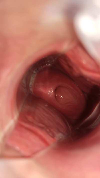 Cow's womb waiting for breeding