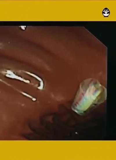 NFC Fantastic Voyage