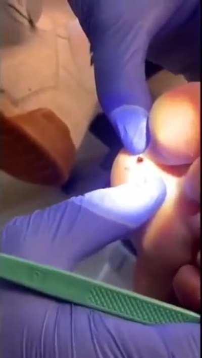 Splinter unit - where you at, TMNT?