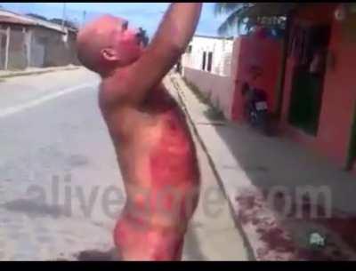 Man cuts off manhood; runs down the street cockfree