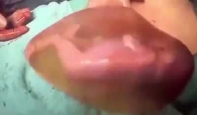 Freaky but amazing to watch this premature (healthy) baby kicking inside its amniotic sac!