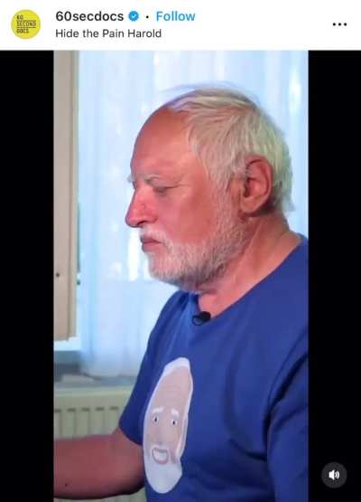 The guy who became Hide the Pain Harold. A living example of the effect every time he smiles.