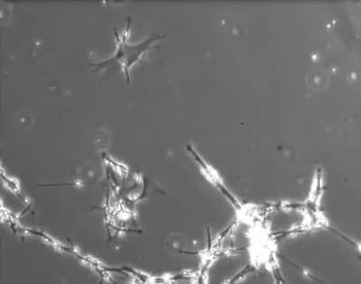 Neurons in a culture dish trying to form connections with each other.