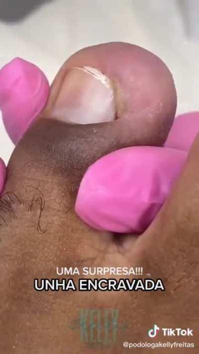 Can't imagine the relief!