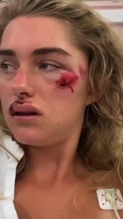 Why did they even invent helmets? Oh right...