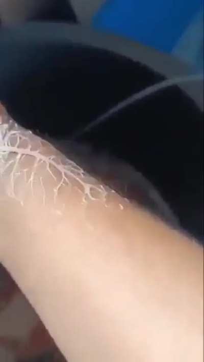 What kind of worm thing is this?