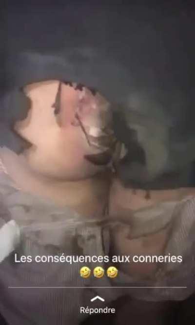 He can't sit for a while