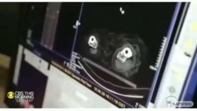 The voice of a 3000 year old Mummy!