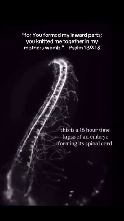 Reposting: Brittany reposts a Live Action (Lila Rose) post showing a 