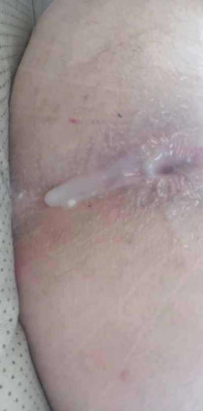 Anal Creampie dripping out with a gape from BBC🍑💦💦