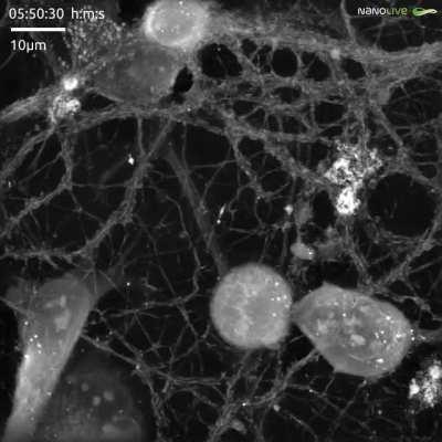 Neurons immune surveillance system (microglia) hard at work
