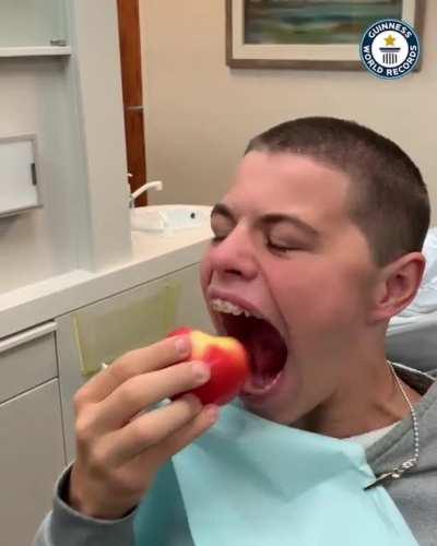 World record of having widest mouth gape(Male)