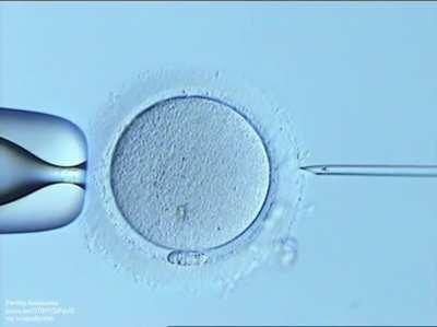 How a single sperm is selected and injected directly into the egg using a fine glass needle