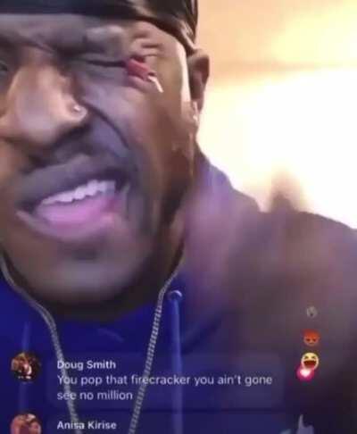 man lights fire cracker in his eye