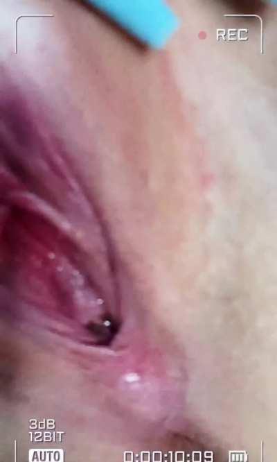 What is in the bottle 🤨