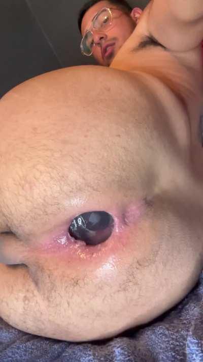 Aaaand this is my loose hole [22]