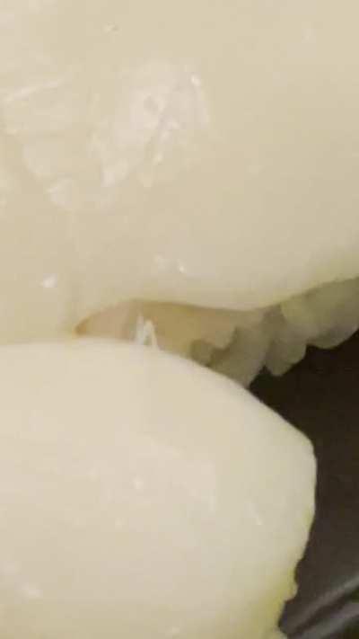 Parasitic worm in omakase sushi from NYC 🙃