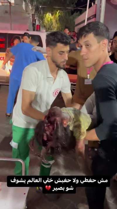 Warning: Graphic! A young girl’s skull and brain shattered and hanging out after Israeli’s strike on Gaza