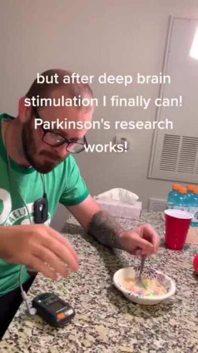 Deep brain stimulation for relieving Parkinson's. This technology is helping millions of people with the disease to properly eat.