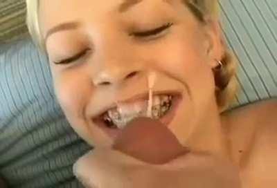 Brace face gets a load