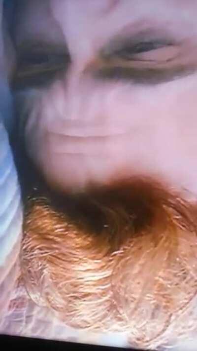 Joaquin Phoenix's Forehead (Rotated)