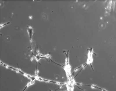 Neurons in a culture dish trying to form connections with each other.