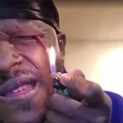 There goes his eye.. *pop*