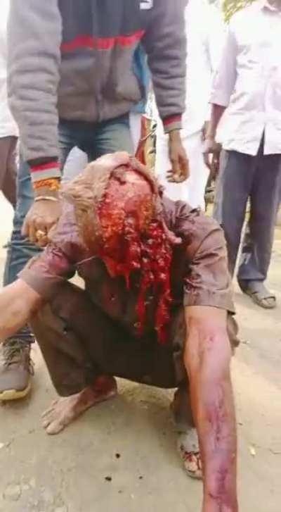 Barely saved alive from a tiger