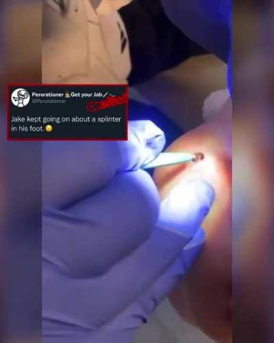 He was complaining about a splinter