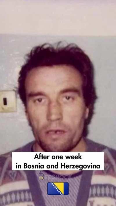 Celebrities before and after balkans