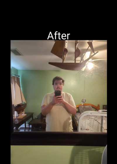 Body transformation made possible with Risperidone