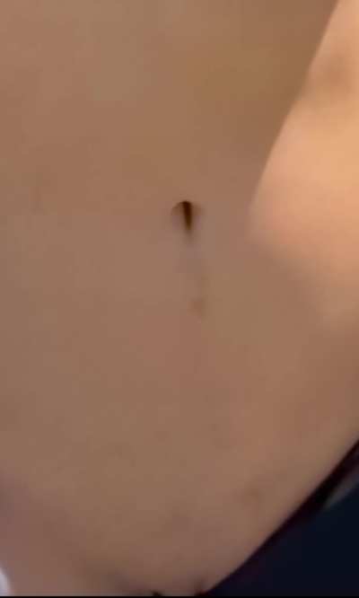 Accidentally loses her bikini bottom