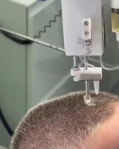 Mesotherapy gun used for micro-injections of vitamins/enzymes/hormones into subcutaneous fat