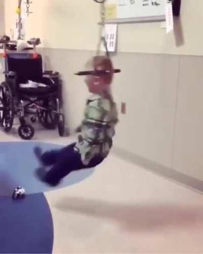 Halo-gravity traction is a technique to gently straighten the spine of children with severe scoliosis