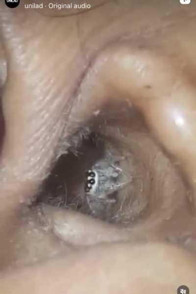 spider living in woman's ear