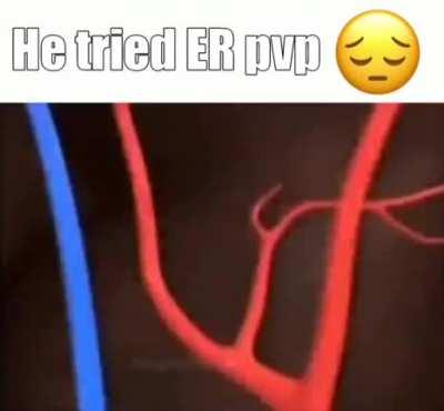 gives me conniptions