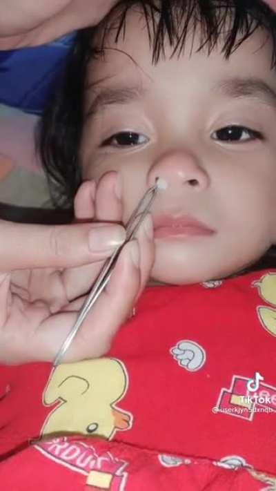This child has something up her nose and....