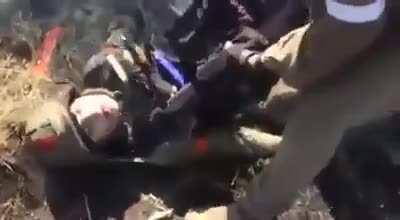 Real face of war for those who love war