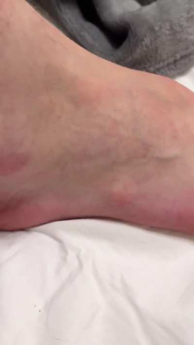 Why does my right foot “pulsate” like this sometimes?