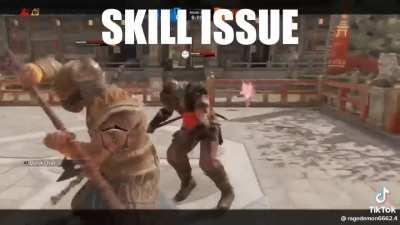 Skill issue.