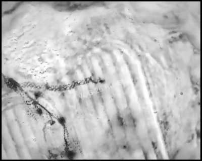 Ukrainian infantry wounded by grenade drops get ran over by an evacuation crew driving a BMP, the dismounts get hit by another grenade