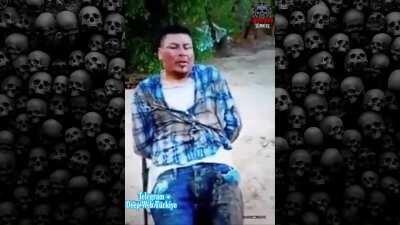 [Global] - (Nsfw) / Man whose legs were cut with a chainsaw