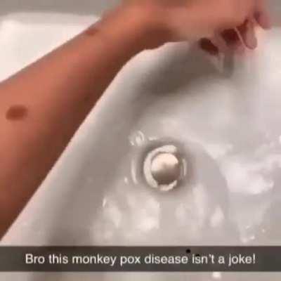 monkeypox virus isn't a game 😭