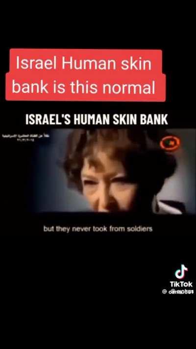 Israel's Human skin bank