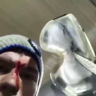 Imagine the damage without the safety glasses